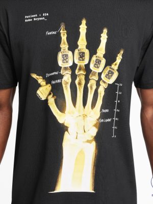 Kobe Bryant Broken Hand Xray And 5 Championship Rings Kobe Bryant Xray T Shirt Hoodie Sweatshirt riracha 3